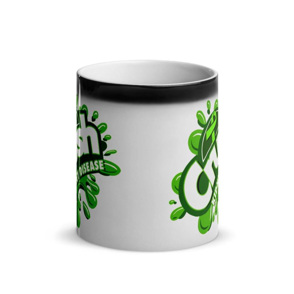 Crush Kidney Disease Glossy Magic Mug